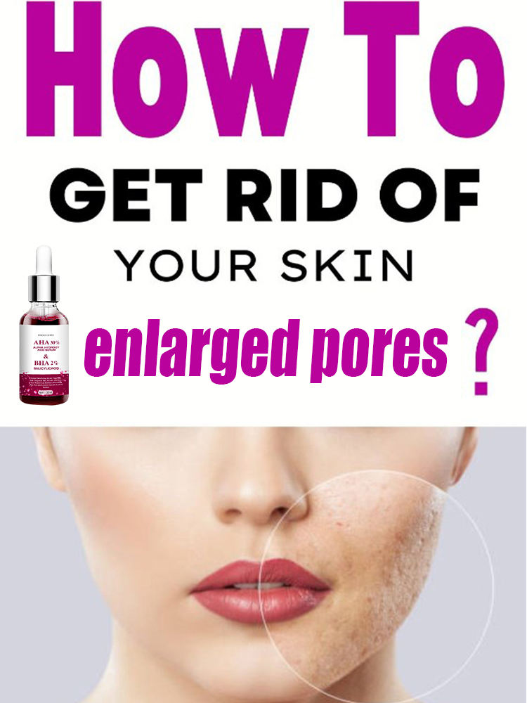 Salicylic Acid Blackhead Remover - Krimpen Poriën Serum Salicyl Fruitzuur Gezicht