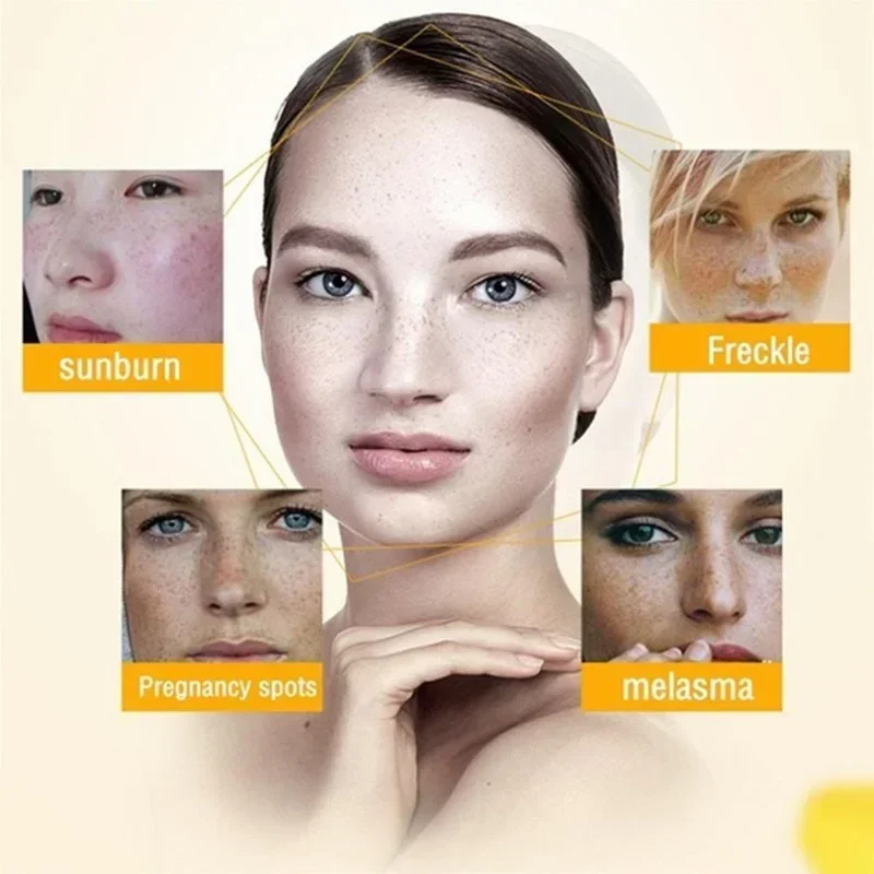 Rimpelcrème verwijderen Retino - Retinol Anti Wrinkle Cream recensie en prijs