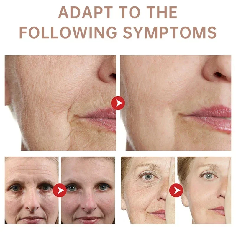 Rimpelcrème verwijderen Retino - Retinol Anti Wrinkle Cream recensie en prijs
