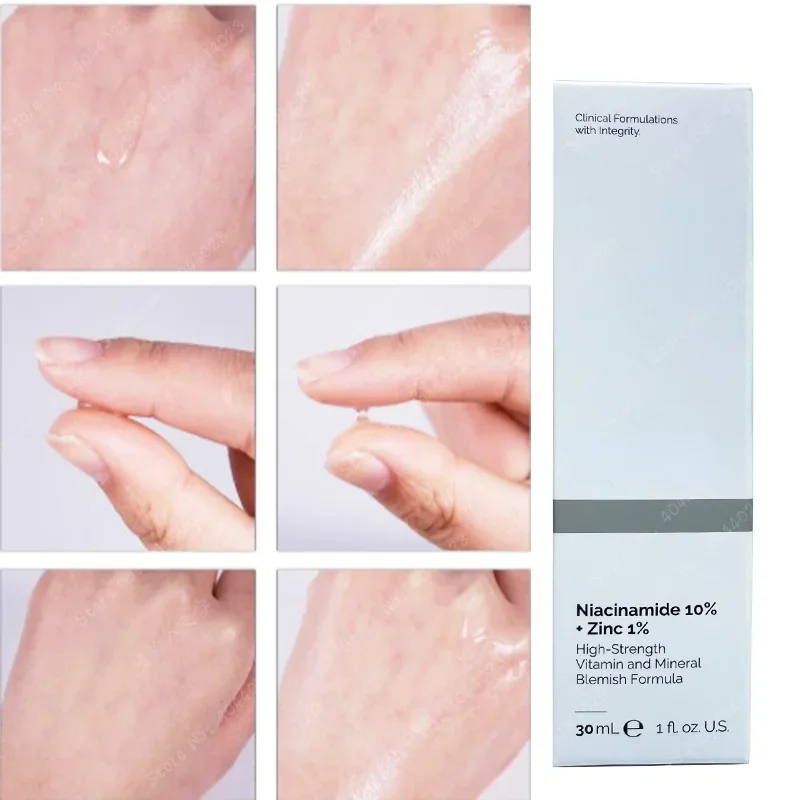 Niacinamide magnesium whitenin - Niacinamide Pore Shrinking Essence recensie en prijs