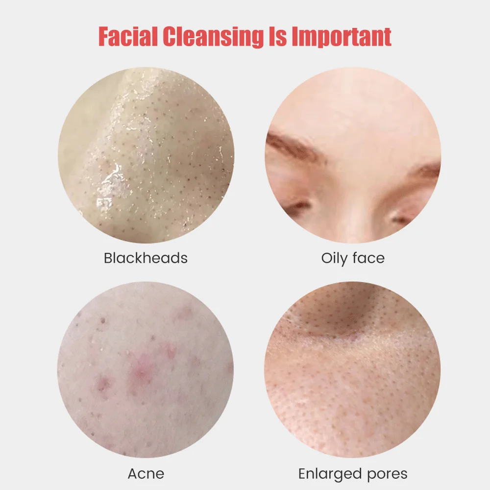 Sonische Siliconen Gezichtsbor - Silicone Face Scrubber Electric recensie en prijs