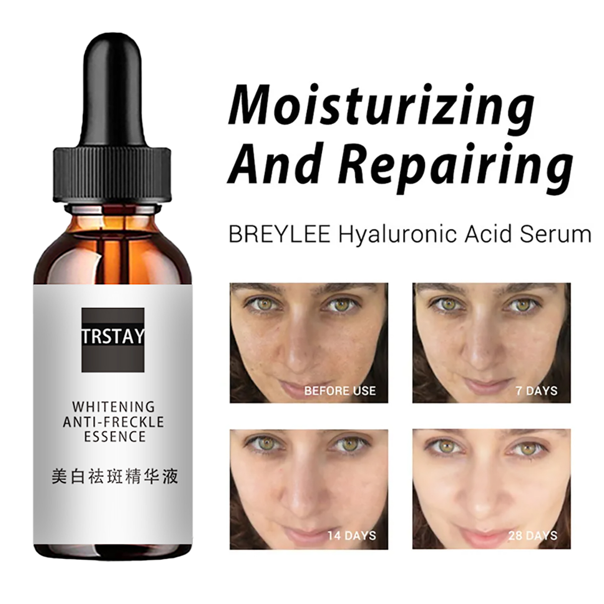 Niacinamide Acid Facial Essenc - Niacinamide Pore Shrinking Essence recensie en prijs