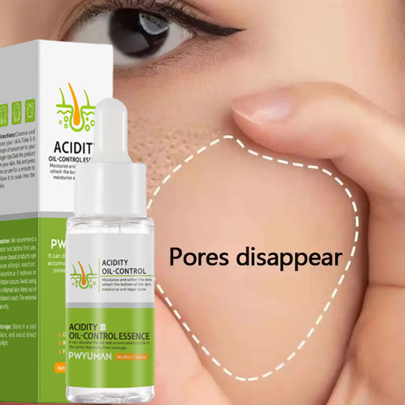 Salicylzuur Poriënverkleinend  - Salicylic Acid Blackhead Remover recensie en prijs
