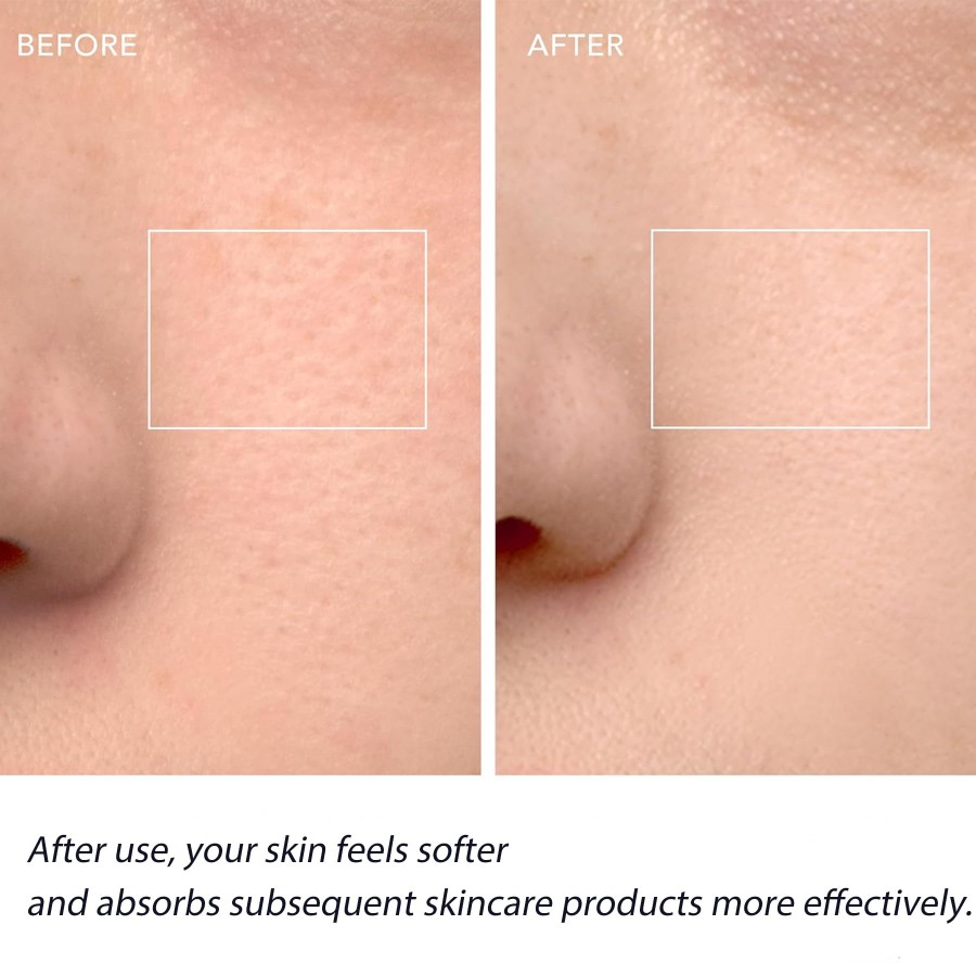 Gezichtsreinigingsborstel, gez - Silicone Face Scrubber Electric recensie en prijs