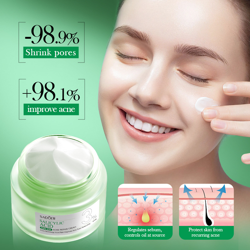 Salicylzuur Acne Behandeling C - Salicylic Acid Blackhead Remover recensie en prijs