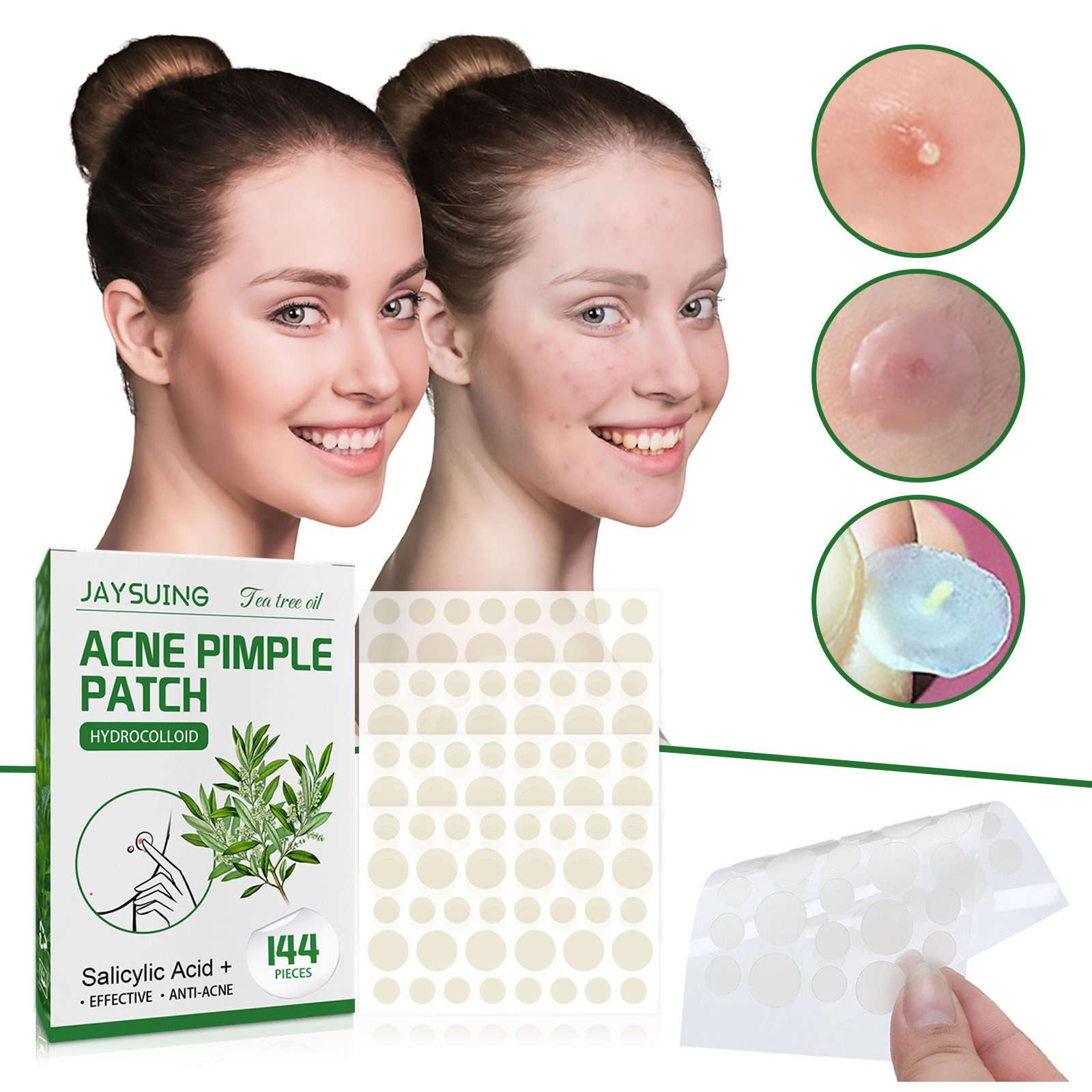 Hydrocolloïde acnepleisters -  - Hydrocolloid Pimple Patch recensie en prijs
