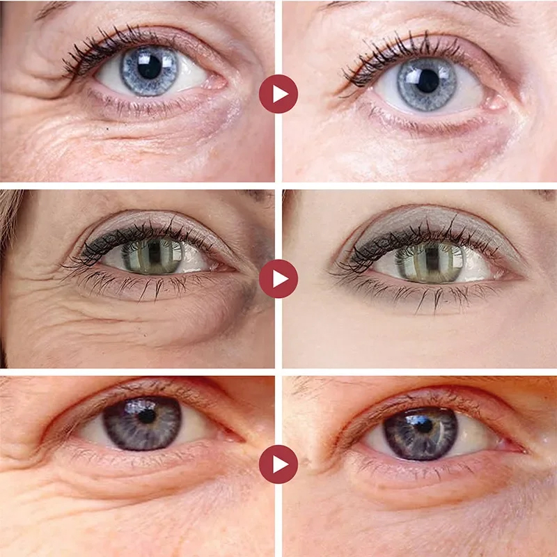 Rimpel Verwijderen Ogen Patche - Collagen Under Eye Patches recensie en prijs