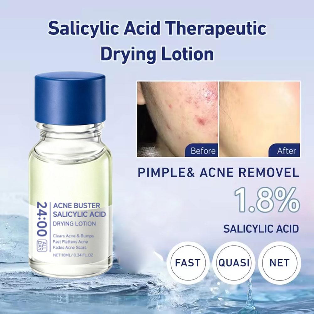 Salicylzuur Acne Verwijderaar  - Salicylic Acid Blackhead Remover recensie en prijs